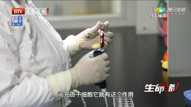 干細胞治療新冠病毒