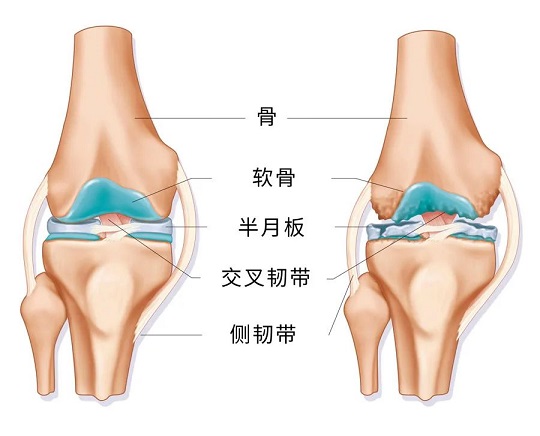 干細(xì)胞治療骨質(zhì)疏松