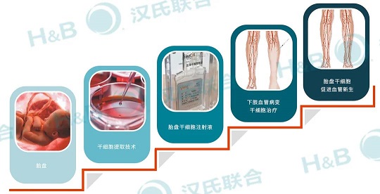 重度下肢缺血治療