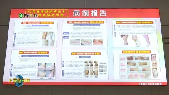 干細胞治療創面修復